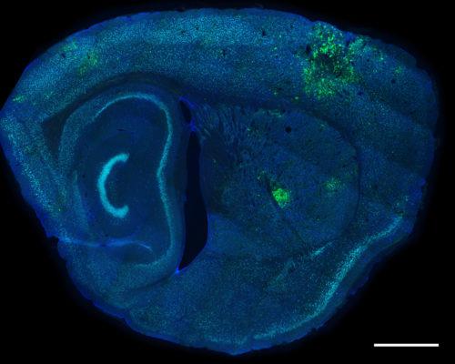 Mouse Brain genetically engineered to show green where Toxoplasma Gondii has infected the brain. (Photo by :Anita Koshy)