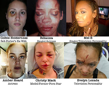 A photo collage of famous domestic violence survivors featuring Rihanna, Colbie Holderness, Mel B, Amber Heard, Christy Mack and Evelyn Lozada. However, domestic violence is experienced by many women around the world. 